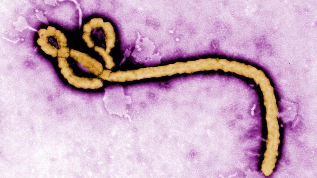 France announces first Ebola case in doctor returned from DR Congo